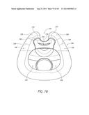 INTERFACE COMPRISING A NASAL SEALING PORTION diagram and image