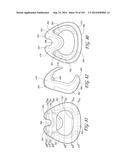 INTERFACE COMPRISING A NASAL SEALING PORTION diagram and image