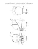 INTERFACE COMPRISING A NASAL SEALING PORTION diagram and image