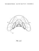 INTERFACE COMPRISING A NASAL SEALING PORTION diagram and image