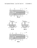 SURGICAL TISSUE SEALER diagram and image