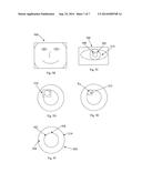 System and Method for Identifying Eye Conditions diagram and image