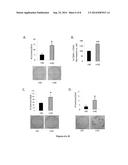 CERAMIDASE AND CELL DIFFERENTIATION diagram and image