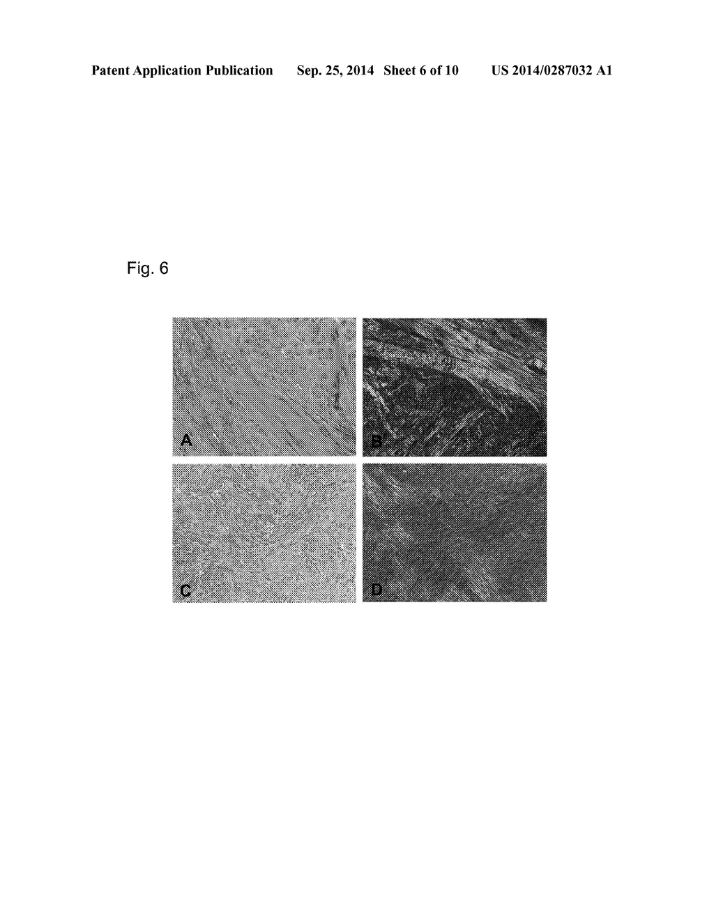 Treatment Method and Product for Uterine Fibroids using Purified     Collagenase - diagram, schematic, and image 07