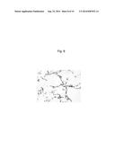 Treatment Method and Product for Uterine Fibroids using Purified     Collagenase diagram and image