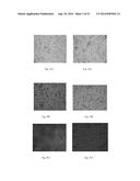 FIBRIN SEALANT (FIBRINGLURAAS) CONSISTING OF A KIT OF LYOPHILIZED OR     FROZEN HIGH CONCENTRATE FRIBINOGEN diagram and image