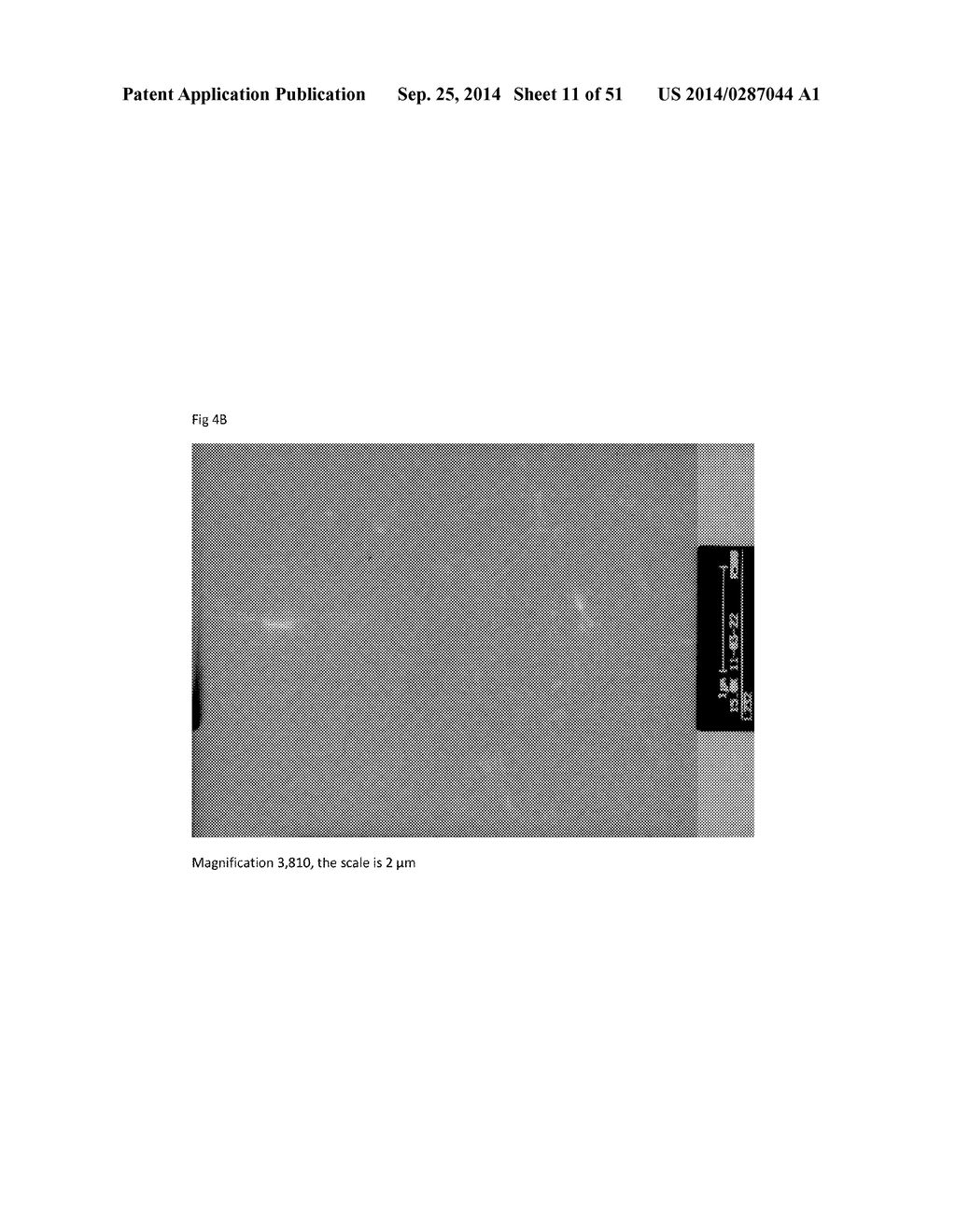 FIBRIN SEALANT (FIBRINGLURAAS) CONSISTING OF A KIT OF LYOPHILIZED OR     FROZEN HIGH CONCENTRATE FRIBINOGEN - diagram, schematic, and image 12