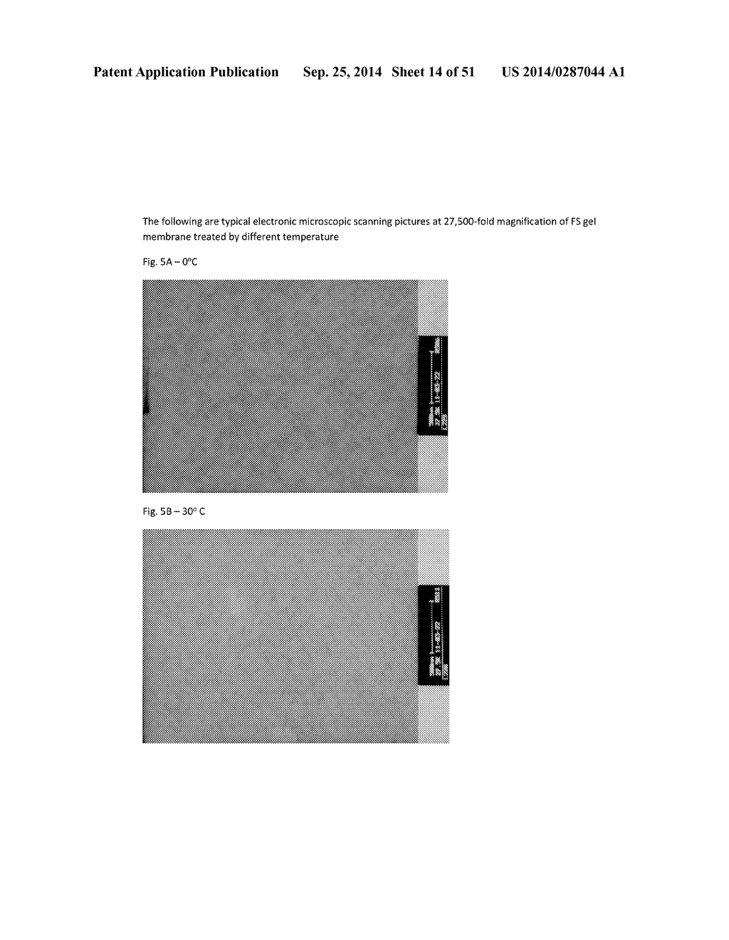 FIBRIN SEALANT (FIBRINGLURAAS) CONSISTING OF A KIT OF LYOPHILIZED OR     FROZEN HIGH CONCENTRATE FRIBINOGEN - diagram, schematic, and image 15