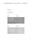 FIBRIN SEALANT (FIBRINGLURAAS) CONSISTING OF A KIT OF LYOPHILIZED OR     FROZEN HIGH CONCENTRATE FRIBINOGEN diagram and image