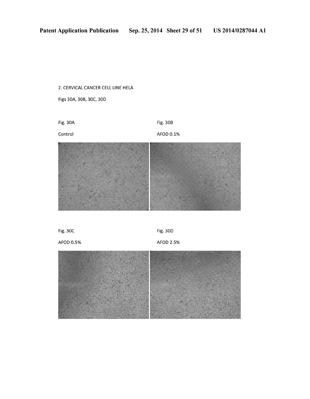 FIBRIN SEALANT (FIBRINGLURAAS) CONSISTING OF A KIT OF LYOPHILIZED OR     FROZEN HIGH CONCENTRATE FRIBINOGEN - diagram, schematic, and image 30