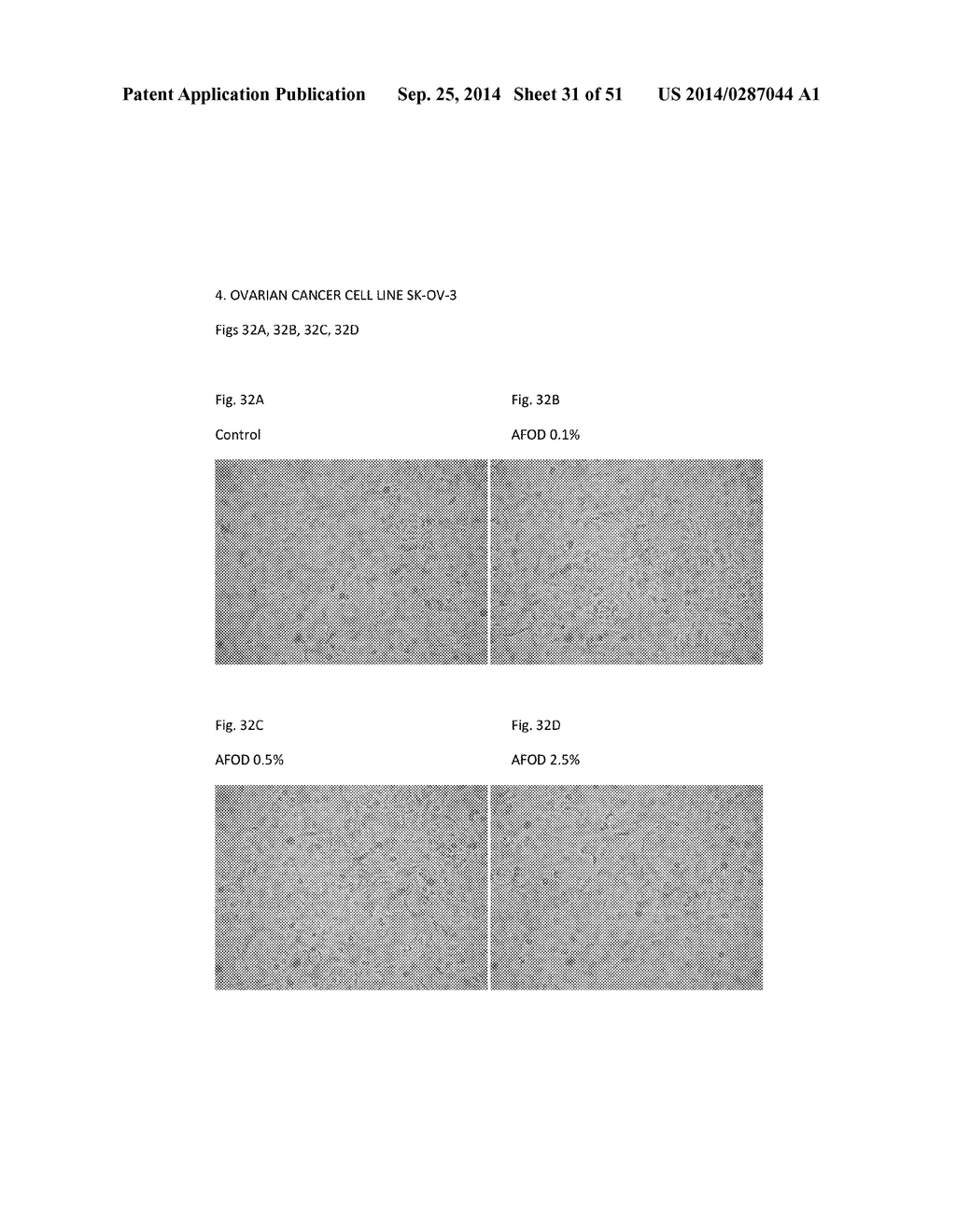 FIBRIN SEALANT (FIBRINGLURAAS) CONSISTING OF A KIT OF LYOPHILIZED OR     FROZEN HIGH CONCENTRATE FRIBINOGEN - diagram, schematic, and image 32