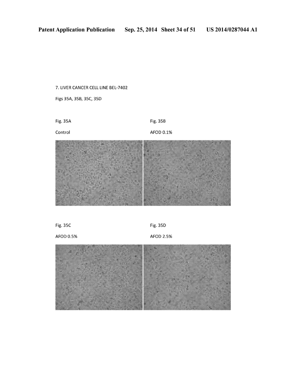 FIBRIN SEALANT (FIBRINGLURAAS) CONSISTING OF A KIT OF LYOPHILIZED OR     FROZEN HIGH CONCENTRATE FRIBINOGEN - diagram, schematic, and image 35