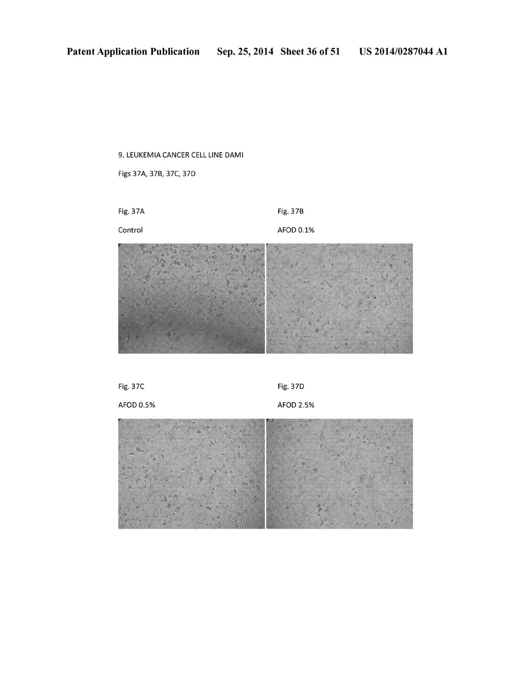 FIBRIN SEALANT (FIBRINGLURAAS) CONSISTING OF A KIT OF LYOPHILIZED OR     FROZEN HIGH CONCENTRATE FRIBINOGEN - diagram, schematic, and image 37