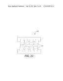 ORTHODONTIC BRACKET PLACEMENT USING BRACKET GUIDE FEATURES diagram and image