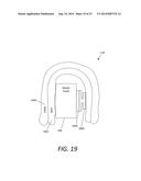 ORTHODONTIC BRACKET PLACEMENT USING BRACKET GUIDE FEATURES diagram and image