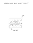 ORTHODONTIC BRACKET PLACEMENT USING BRACKET GUIDE FEATURES diagram and image