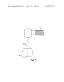 GUIDED DENTAL IMPLANTATION SYSTEM AND ASSOCIATED DEVICE AND METHOD diagram and image