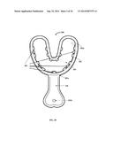 Determination Of A Three Dimensional Relation Between Upper and Lower Jaws     With Reference To A Temporomandibular Joint diagram and image