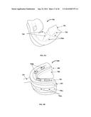 Determination Of A Three Dimensional Relation Between Upper and Lower Jaws     With Reference To A Temporomandibular Joint diagram and image