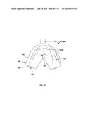 Determination Of A Three Dimensional Relation Between Upper and Lower Jaws     With Reference To A Temporomandibular Joint diagram and image