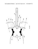 Determination Of A Three Dimensional Relation Between Upper and Lower Jaws     With Reference To A Temporomandibular Joint diagram and image