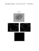 HUMAN DISC TISSUE diagram and image