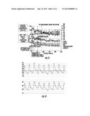 Methods for the Treatment of Cardiovascular Conditions diagram and image