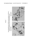 THYMIDINE KINASE GENE diagram and image