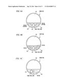 SUCTION CATHETER diagram and image