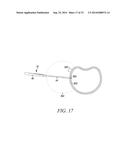 SURGICAL ACCESS SYSTEM AND RELATED METHODS diagram and image