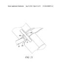 SURGICAL ACCESS SYSTEM AND RELATED METHODS diagram and image