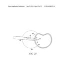 SURGICAL ACCESS SYSTEM AND RELATED METHODS diagram and image