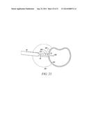 SURGICAL ACCESS SYSTEM AND RELATED METHODS diagram and image