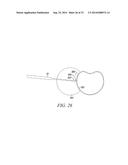 SURGICAL ACCESS SYSTEM AND RELATED METHODS diagram and image