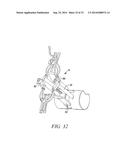 SURGICAL ACCESS SYSTEM AND RELATED METHODS diagram and image