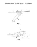 MULTI-FUNCTIONAL CATHETER diagram and image