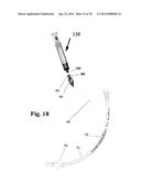 PRESSURE REGULATING SYRINGE AND METHOD THEREFOR diagram and image