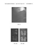 UV IMAGING FOR INTRAOPERATIVE TUMOR DELINEATION diagram and image