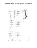 Multi-Channel Cardiac Measurements diagram and image