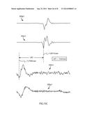 Multi-Channel Cardiac Measurements diagram and image