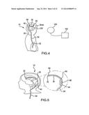 VENTRICULAR SHUNT SYSTEM AND METHOD diagram and image