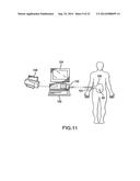 VENTRICULAR SHUNT SYSTEM AND METHOD diagram and image