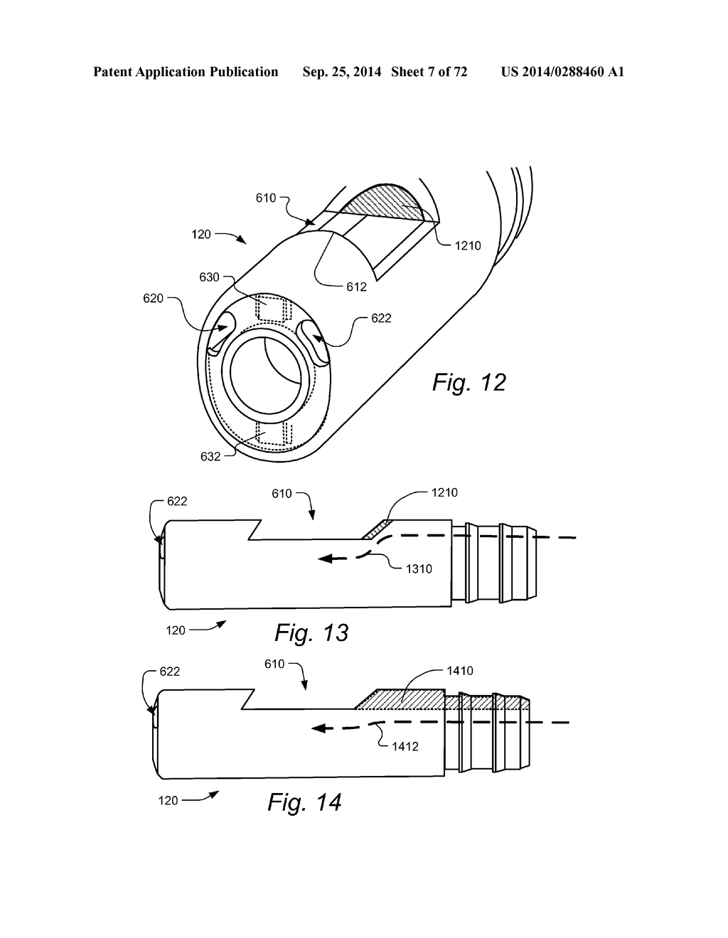 METHOD AND APPARATUS FOR HYSTEROSCOPY AND ENDOMETRIAL BIOPSY - diagram, schematic, and image 08