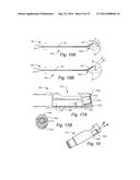 METHOD AND APPARATUS FOR HYSTEROSCOPY AND ENDOMETRIAL BIOPSY diagram and image