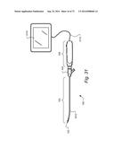 METHOD AND APPARATUS FOR HYSTEROSCOPY AND ENDOMETRIAL BIOPSY diagram and image