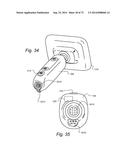 METHOD AND APPARATUS FOR HYSTEROSCOPY AND ENDOMETRIAL BIOPSY diagram and image