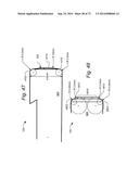 METHOD AND APPARATUS FOR HYSTEROSCOPY AND ENDOMETRIAL BIOPSY diagram and image