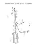 METHOD AND APPARATUS FOR HYSTEROSCOPY AND ENDOMETRIAL BIOPSY diagram and image