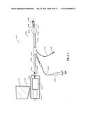 METHOD AND APPARATUS FOR HYSTEROSCOPY AND ENDOMETRIAL BIOPSY diagram and image