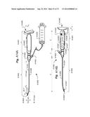 METHOD AND APPARATUS FOR HYSTEROSCOPY AND ENDOMETRIAL BIOPSY diagram and image